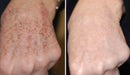 Facial Mask Skin Care - Remove manchas de Idade, Sol e Melasma! Para mãos e Rosto! FRETE GRÁTIS - Remove manchas de Idade, Sol e Melasma! Para mãos e Rosto! FRETE GRÁTIS