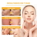 Facial Mask Skin Care - Remove manchas de Idade, Sol e Melasma! Para mãos e Rosto! FRETE GRÁTIS - Remove manchas de Idade, Sol e Melasma! Para mãos e Rosto! FRETE GRÁTIS
