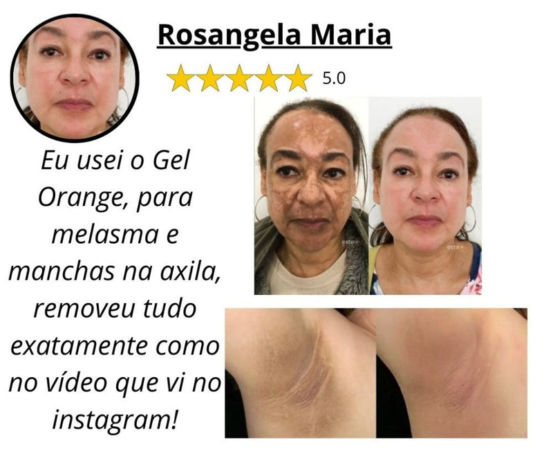 Gel Esfoliador Orange | Acabe de Vez com Manchas Escuras! FRETE GRÁTIS